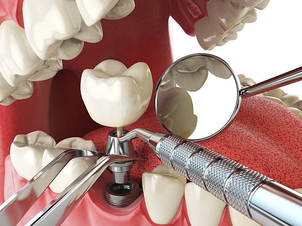 Best Emergency Gum Treatment in Lakewood, CA